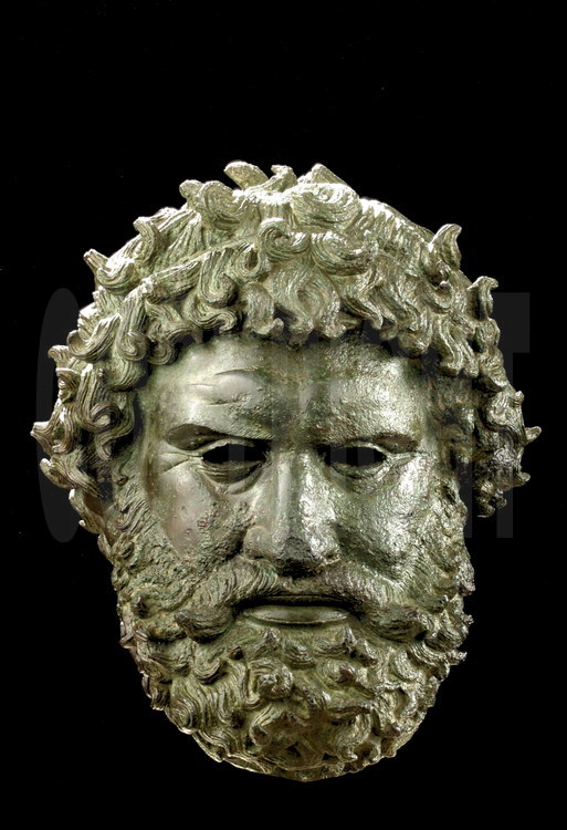 Head of a fighter wearing the characteristic winner’s armband.  Fragment of a statue discovered on the sanctuary of Olympia.  The nose is characteristically deformed. National Archeological Museum of Athens.